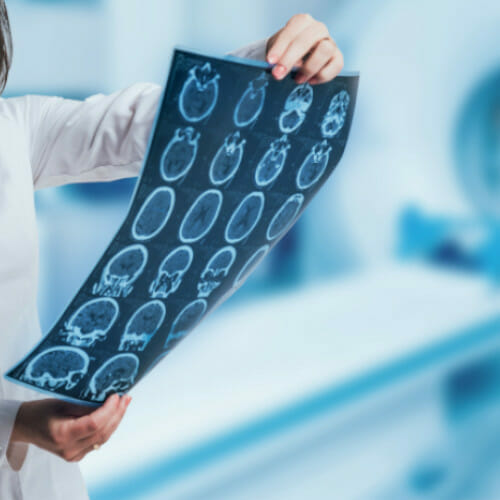 mri-scan