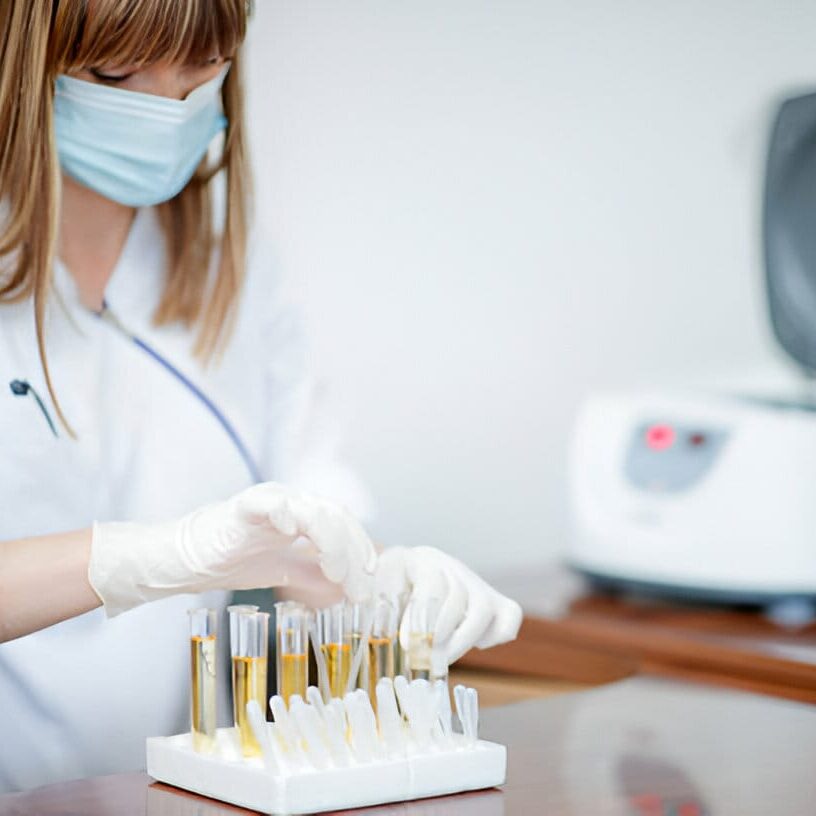 Urine Tests 3